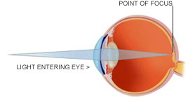 normal-sight