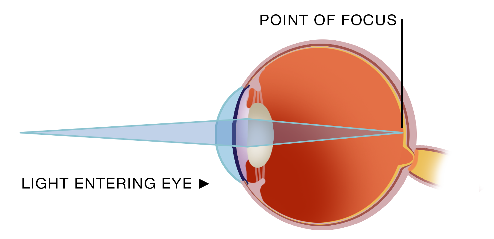 Eye and Vision Conditions