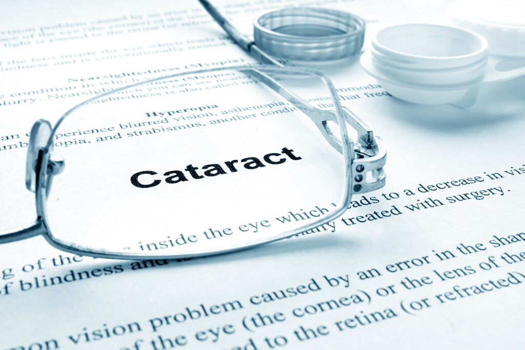 Cataract Causes, Symptoms and Treatments in Melbourne